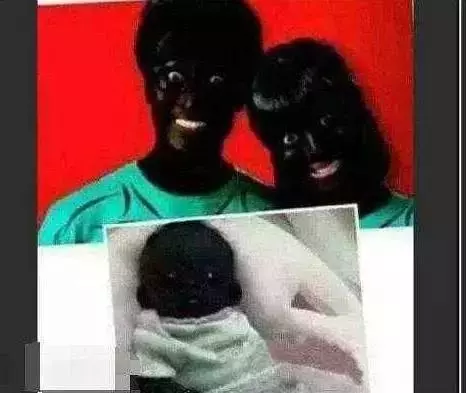 曾經紅遍網路的「世界上最黑嬰兒」，三年後的今天怎麼樣了