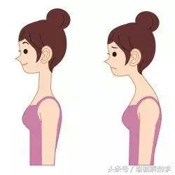 圓肩駝背頭前傾,這是上交叉綜合徵,這樣來調整!