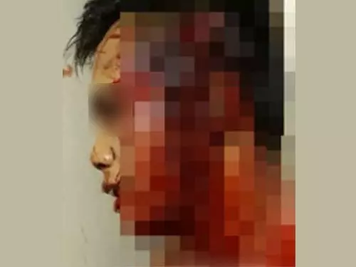 男子躲進酒店避劫 疑被尋仇打成血人