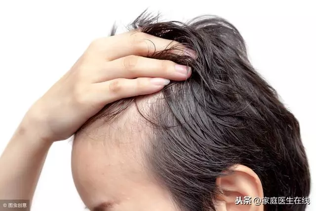 男性為什麼容易脫髮?主要是這幾個原因!