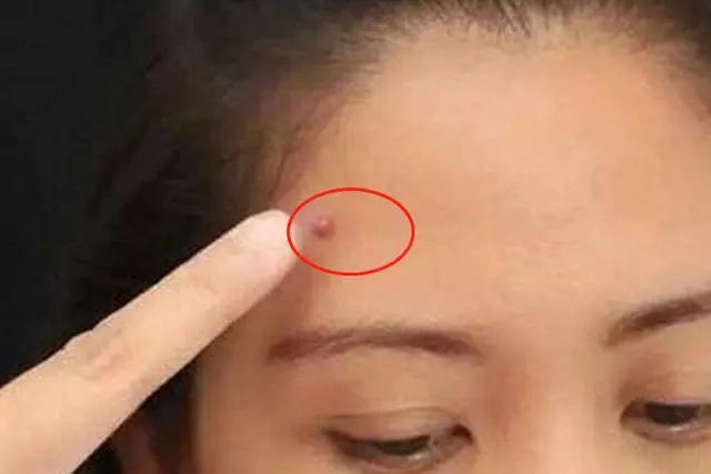 肝不好,【解毒功能】下降 !臉上會有4個「變化」 ,1個沒有,恭喜你,肝很健康
