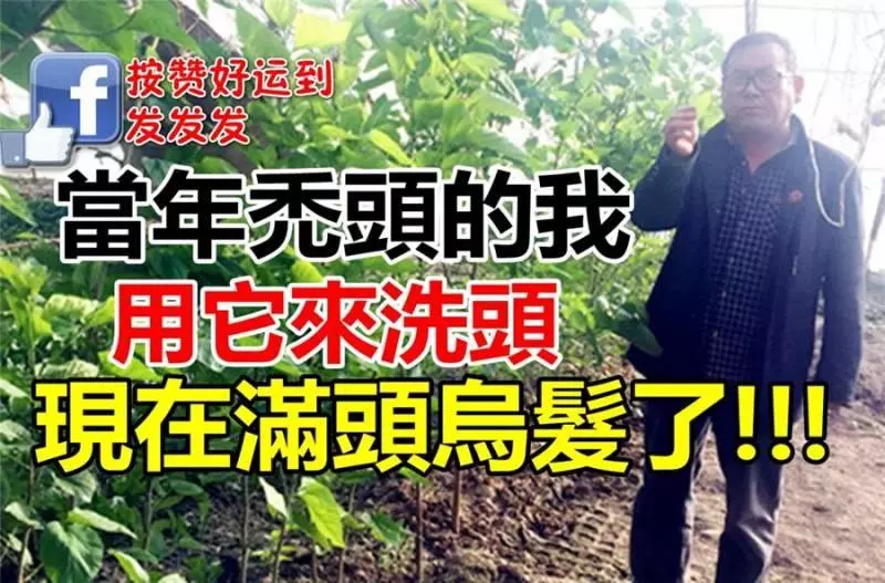 「經典治發秘方」當年禿頭的我,用它來洗頭,現在滿頭烏髮! 朋友還以為是假髮呢!!