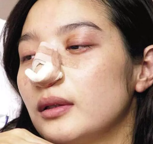 才結婚13天就離婚,老公砍斷她手指,踢死胎兒,她至今仍單身