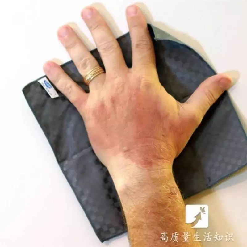 被燙傷了別急,教你正確的解決方法