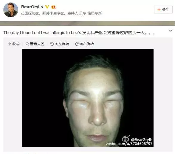 他為了體驗各地美食文化,百無禁忌「生斑馬烏龜」什麼都吃,卻付出過慘烈的代價!