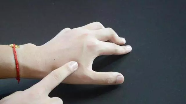 一瓶過期的眼藥水,原來還能這麼用,可惜很多人都扔了!