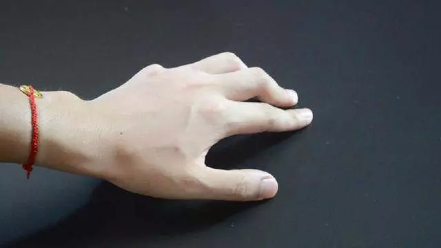 一瓶過期的眼藥水,原來還能這麼用,可惜很多人都扔了!
