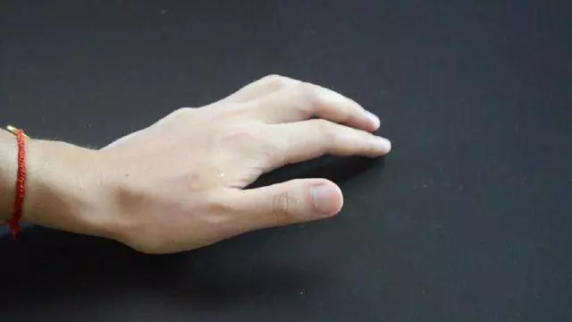 一瓶過期的眼藥水,原來還能這麼用,可惜很多人都扔了!