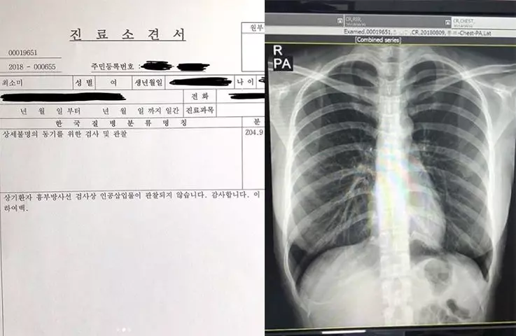 南韓郭雪芙傲人上圍遭懷疑「塞的」 她放X光照打臉:就說是真的了!