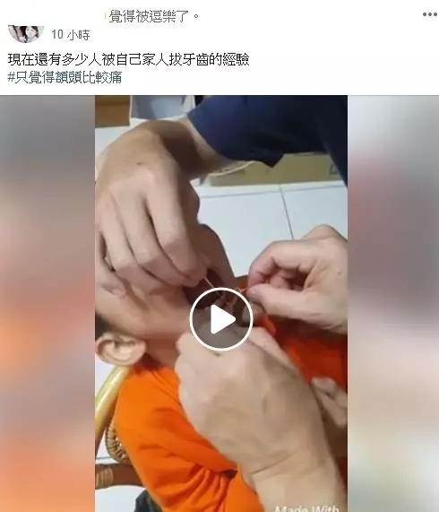 小時候的回憶~男孩給家人用繩子拔牙 牙齒瞬間掉!可是額頭爆了XD