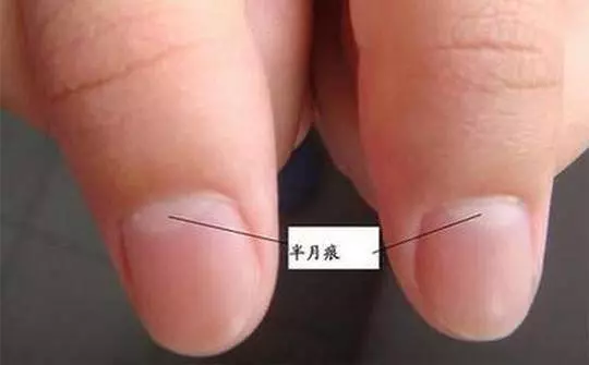 看手指的這裡你就會知道, 可能是患上了糖尿病, 看過都說准!