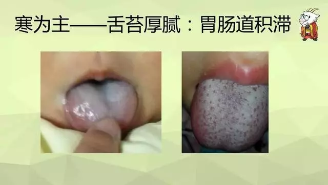 如何用艾灸調理鼻炎、寒性便秘、咳嗽、哮喘、過敏體質