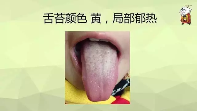 如何用艾灸調理鼻炎、寒性便秘、咳嗽、哮喘、過敏體質