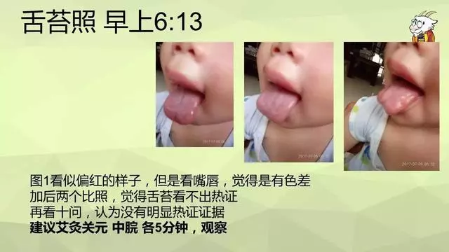如何用艾灸調理鼻炎、寒性便秘、咳嗽、哮喘、過敏體質
