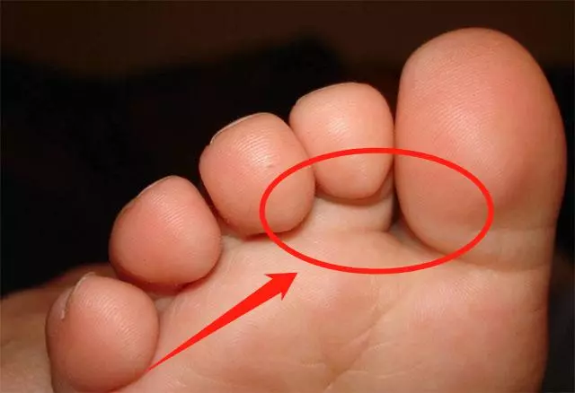 腎臟受損時,晚上睡覺手腳無這4個現象,你若也都無,腎就很健康