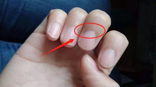 腎臟受損時,晚上睡覺手腳無這4個現象,你若也都無,腎就很健康