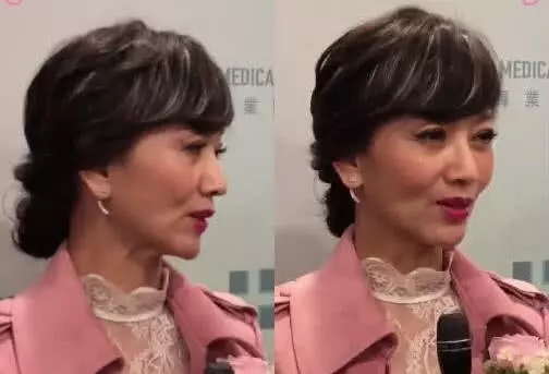 64歲趙雅芝亮相,看著卻像80歲,網友:美顏相機欺騙了多少人!