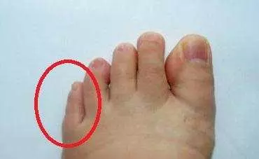「腎」不好腳知道,如果腳上沒有這4個表現,恭喜!你的腎很健康