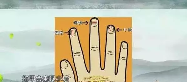 超神奇!經常喝酒、黑眼圈、指甲有條紋的人肝不好?經常喝這個【 解鬱茶】,肝病一星期見效!