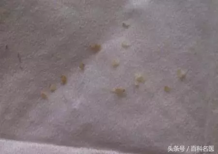 下巴上長出許多白色的小點點,是怎麼回事兒?該怎麼處理呢?