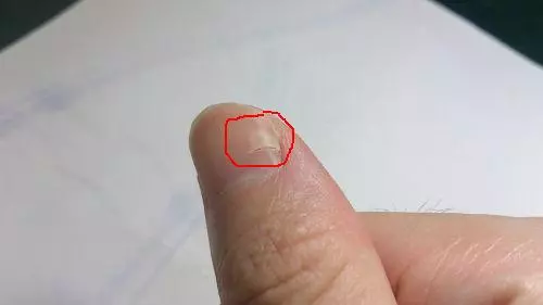 指甲出現這五個狀況不要忽視,可能是大病的預兆