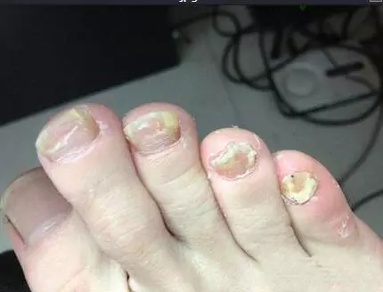 樹枯根先竭,人老腳先衰!腳部出現這幾種癥狀,請一定別忽視!可能是這些疾病的信號!