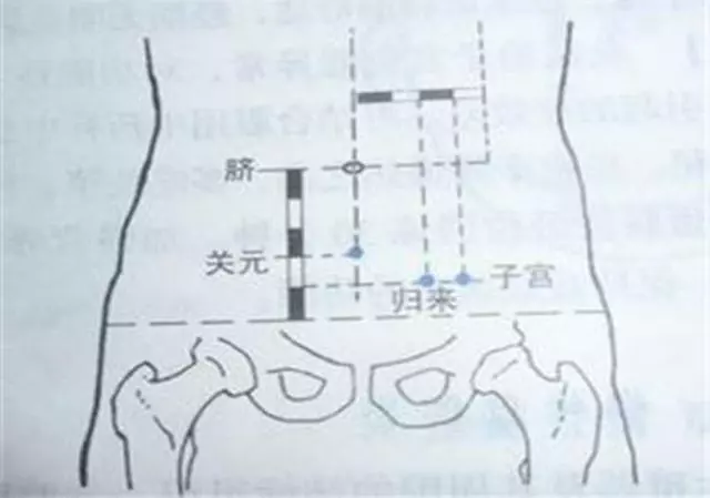 止痛,你還只想到止疼片?那你就錯了,常用的「止疼穴」,請收藏