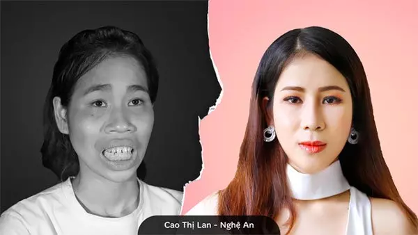 越妹整容整太美 媽媽嚇到推開她