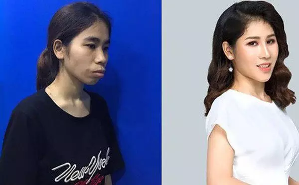越妹整容整太美 媽媽嚇到推開她