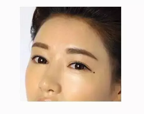 女人臉上的七顆幸運痣