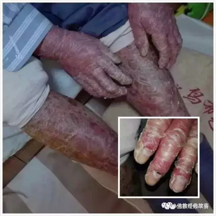 阿彌陀佛給了我第二次生命!把我的事說出去 勸人念佛!