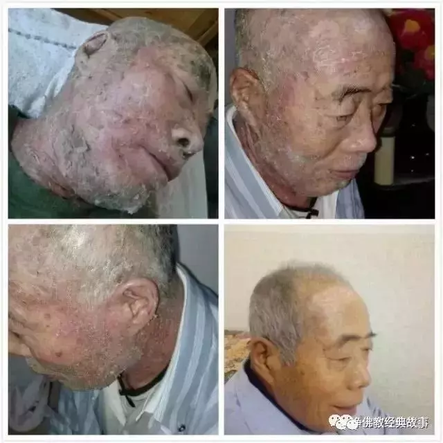 阿彌陀佛給了我第二次生命!把我的事說出去 勸人念佛!