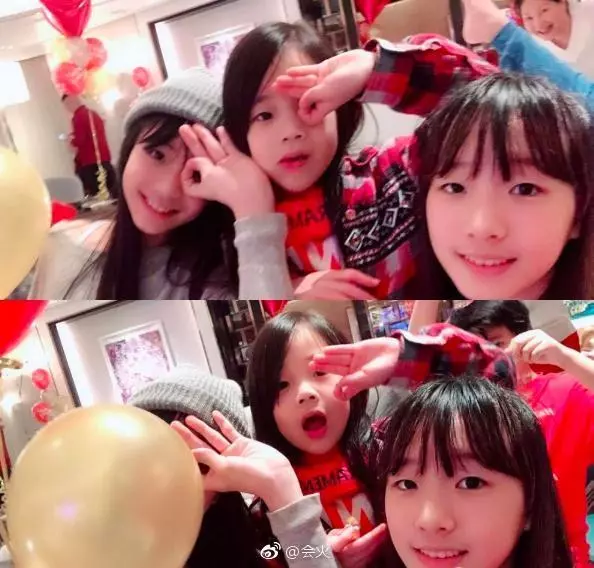 小S 女兒從「醜小鴨」整容式「美炸天」!倒是她臉部僵硬認不出了!