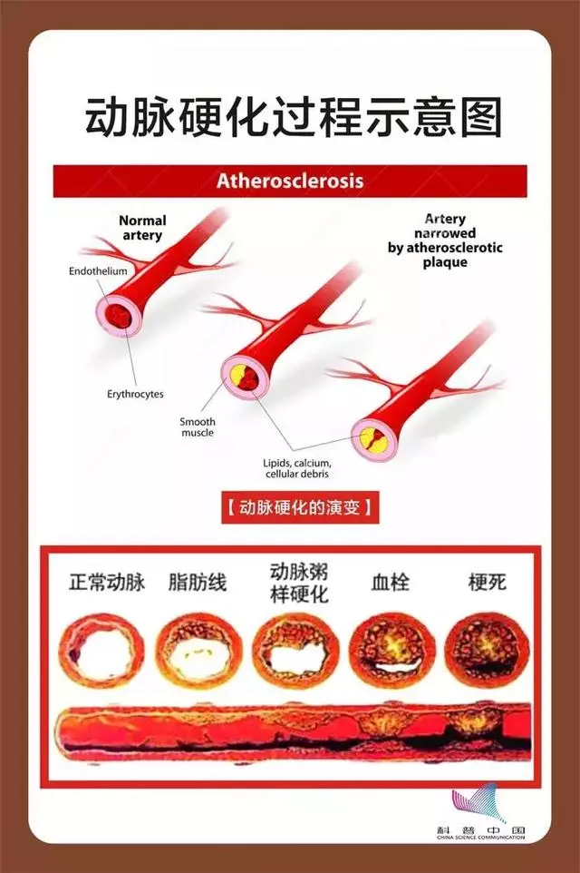 吃鹽越少就越健康?未必!盲目低鹽飲食有隱患,快看!