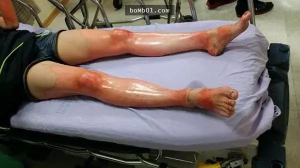 20多歲的女生坐博愛座被阿伯怒罵「好手好腳卻不讓座」,當她含淚拉開衣服後整車廂都傻了!…