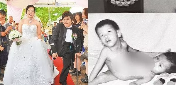 記得轟動全台「開刀12小時分割」的連體嬰嗎?如今他看著妻子「生下雙胞胎....」忍不住哭了!