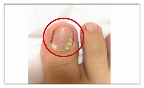 腳部的「這些變化」,都是疾病信號,你注意到了嗎?千萬不要忽視