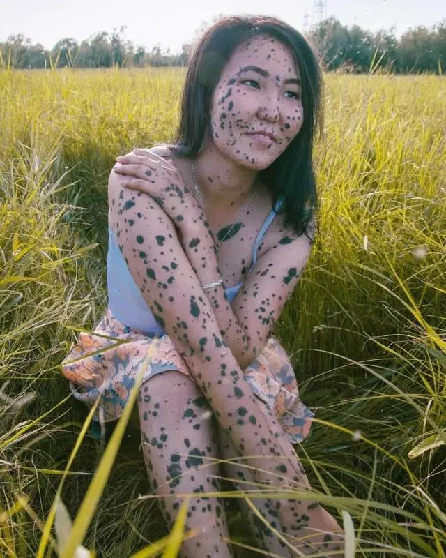 一個眼睛兩個瞳孔!20張證明「你根本就不了解人類」的罕見人類照