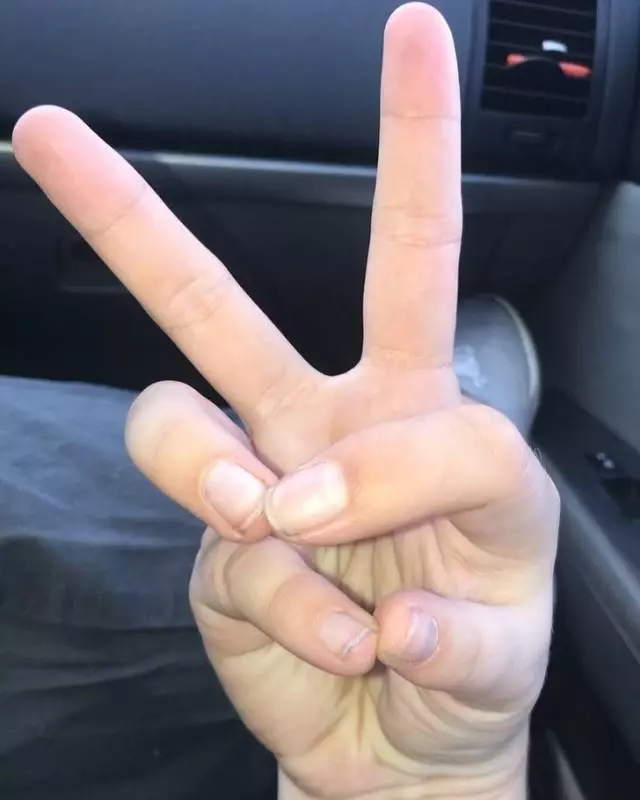 一個眼睛兩個瞳孔!20張證明「你根本就不了解人類」的罕見人類照