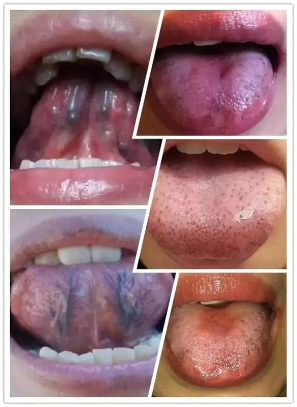 中醫:三七粉功效多!服用三七粉有7大禁忌,不可不知,為了自己和家人的健康要知道