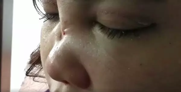 想取消叫車服務,GrabCar司機打斷16歲女孩鼻樑骨!