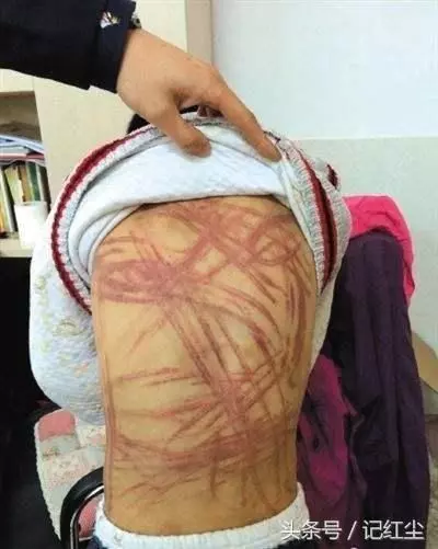 四歲男孩喊肚子疼,父親帶他醫院檢查,醫生瞞著父親報了警