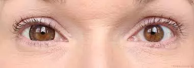 2歲「大眼萌娃」眼睛超大像戴放大片 醫生:可能以後會看不到這世界的美好