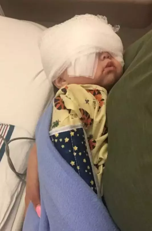 2歲「大眼萌娃」眼睛超大像戴放大片 醫生:可能以後會看不到這世界的美好