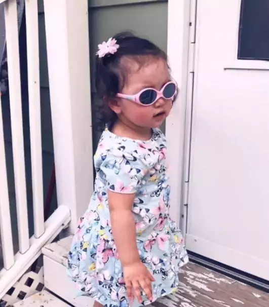 2歲「大眼萌娃」眼睛超大像戴放大片 醫生:可能以後會看不到這世界的美好
