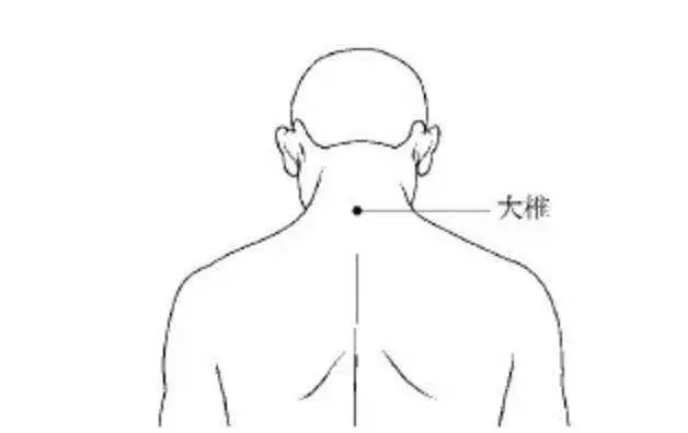 20種病症的針灸取穴及操作手法精華總結(收了吧!)