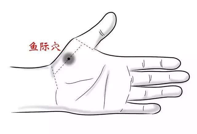 20種病症的針灸取穴及操作手法精華總結(收了吧!)