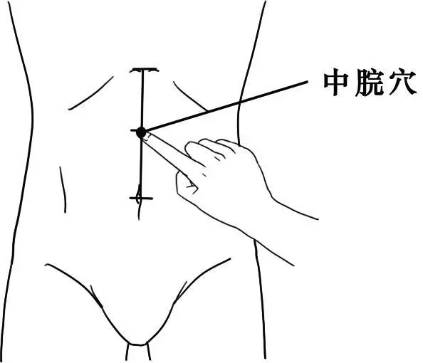 20種病症的針灸取穴及操作手法精華總結(收了吧!)