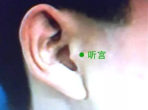 穴位養生:耳前按摩3分鐘,消除耳鳴暈眩、牙疼頭痛!