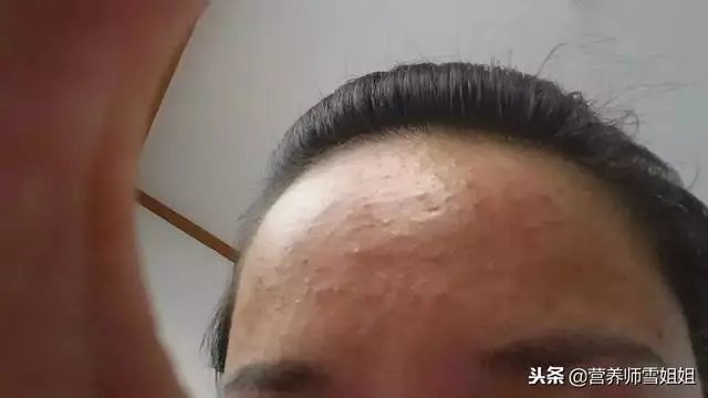 人之衰老,肝為先導,滋肝養肝「三步走」,肝好一切都好!